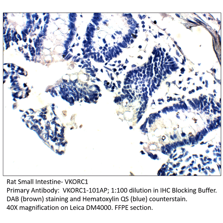 Anti-VKORC1 Antibody from FabGennix (VKORC1-101AP) - Antibodies.com