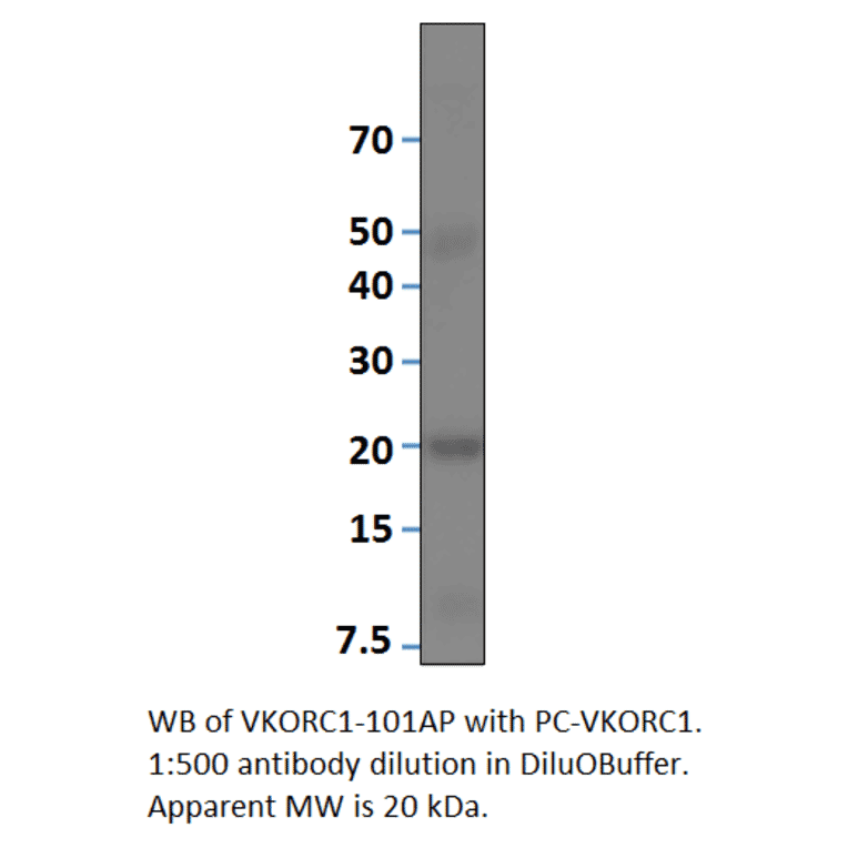 Anti-VKORC1 Antibody from FabGennix (VKORC1-101AP) - Antibodies.com