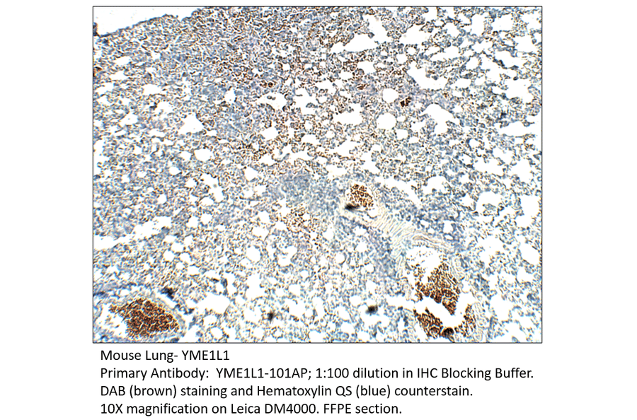Anti-YME1L1 Antibody from FabGennix (YME1L1-101AP) - Antibodies.com