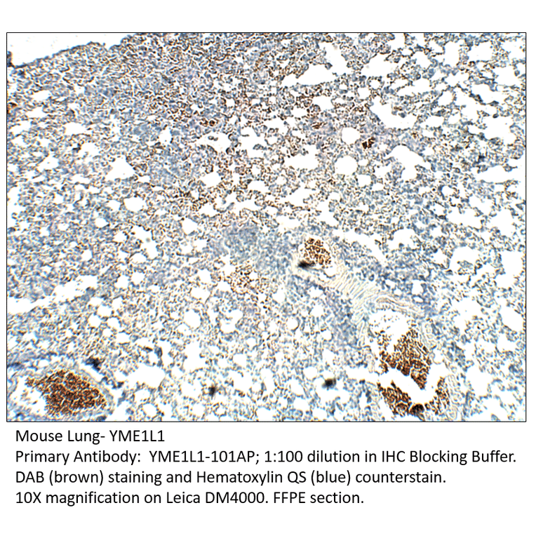 Anti-YME1L1 Antibody from FabGennix (YME1L1-101AP) - Antibodies.com
