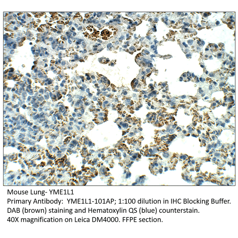 Anti-YME1L1 Antibody from FabGennix (YME1L1-101AP) - Antibodies.com