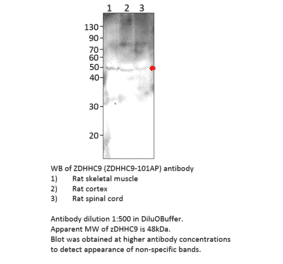 Anti-ZDHHC9 Antibody from FabGennix (ZDHHC9-901AP) - Antibodies.com