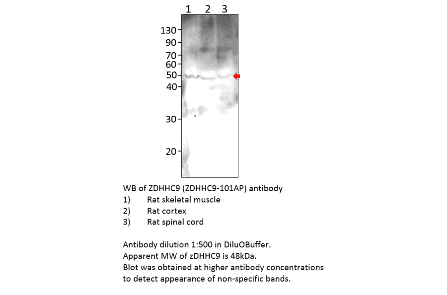 Anti-ZDHHC9 Antibody from FabGennix (ZDHHC9-901AP) - Antibodies.com