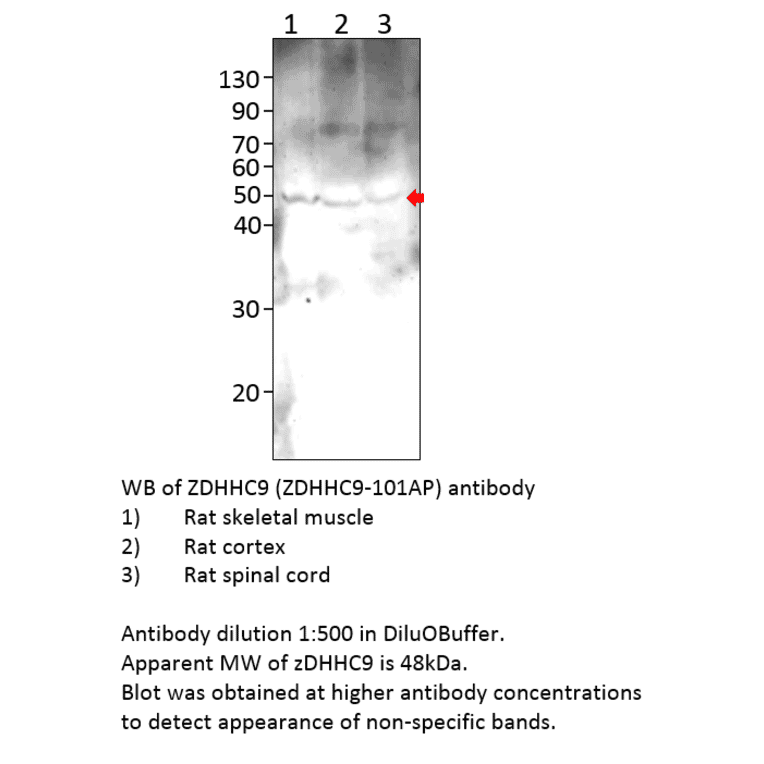 Anti-ZDHHC9 Antibody from FabGennix (ZDHHC9-901AP) - Antibodies.com