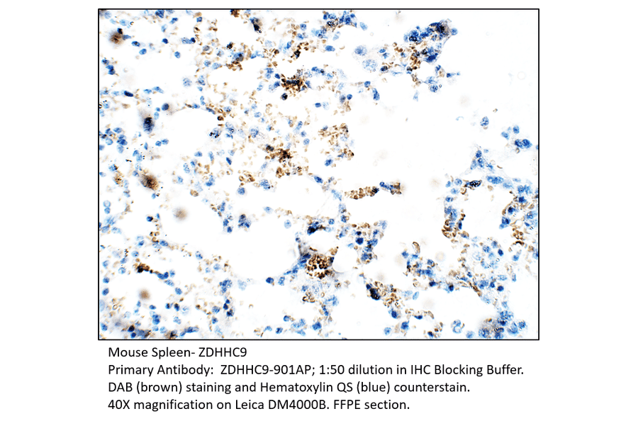 Anti-ZDHHC9 Antibody from FabGennix (ZDHHC9-901AP) - Antibodies.com