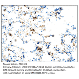 Anti-ZDHHC9 Antibody from FabGennix (ZDHHC9-901AP) - Antibodies.com