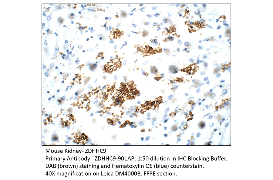 Anti-ZDHHC9 Antibody from FabGennix (ZDHHC9-901AP) - Antibodies.com