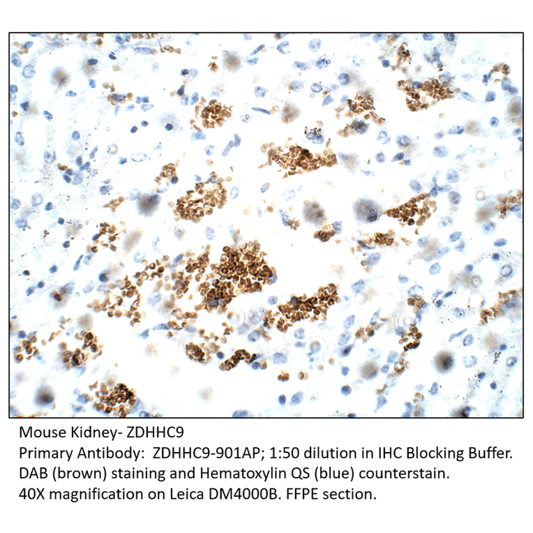 Anti-ZDHHC9 Antibody from FabGennix (ZDHHC9-901AP) - Antibodies.com