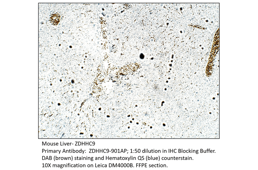 Anti-ZDHHC9 Antibody from FabGennix (ZDHHC9-901AP) - Antibodies.com