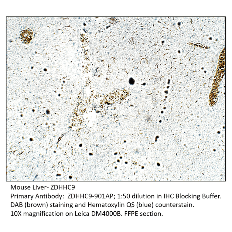 Anti-ZDHHC9 Antibody from FabGennix (ZDHHC9-901AP) - Antibodies.com