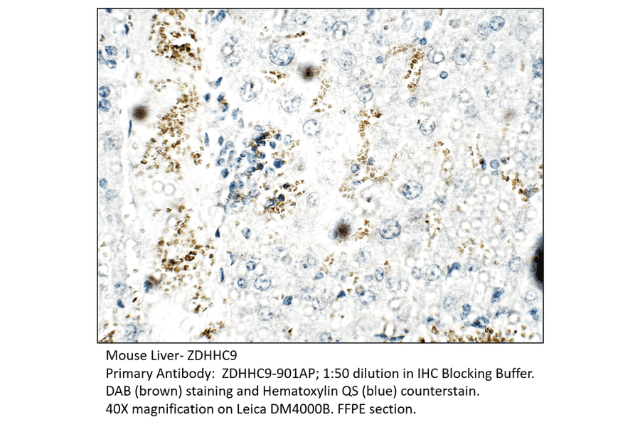 Anti-ZDHHC9 Antibody from FabGennix (ZDHHC9-901AP) - Antibodies.com