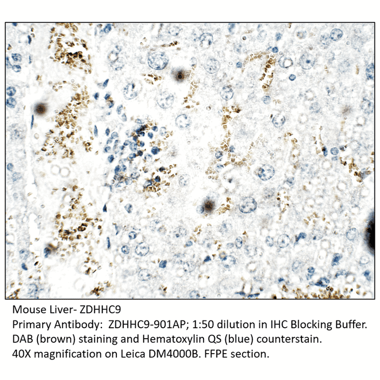 Anti-ZDHHC9 Antibody from FabGennix (ZDHHC9-901AP) - Antibodies.com