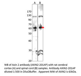 Anti-Axin 2 Antibody from FabGennix (AXIN2-201AP) - Antibodies.com