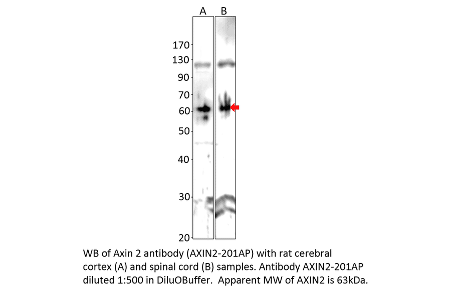 Anti-Axin 2 Antibody from FabGennix (AXIN2-201AP) - Antibodies.com