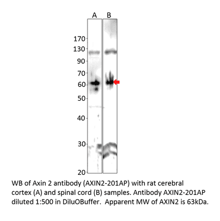 Anti-Axin 2 Antibody from FabGennix (AXIN2-201AP) - Antibodies.com