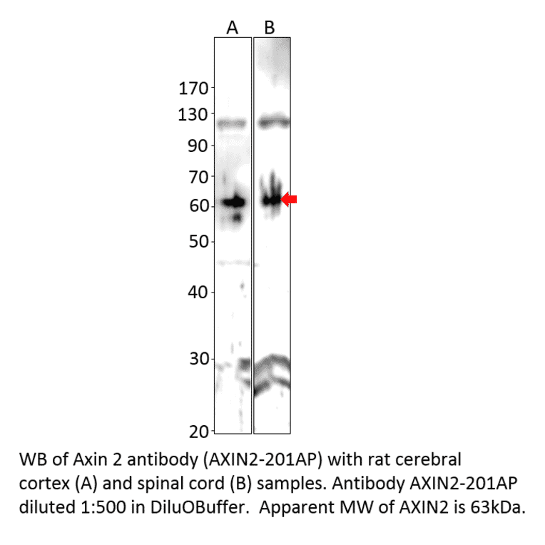 Anti-Axin 2 Antibody from FabGennix (AXIN2-201AP) - Antibodies.com