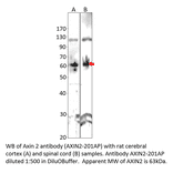 Anti-Axin 2 Antibody from FabGennix (AXIN2-201AP) - Antibodies.com