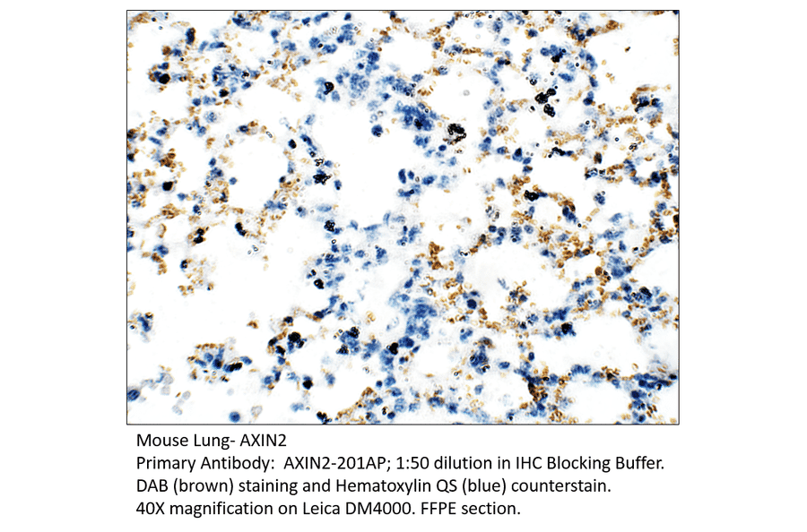 Anti-Axin 2 Antibody from FabGennix (AXIN2-201AP) - Antibodies.com