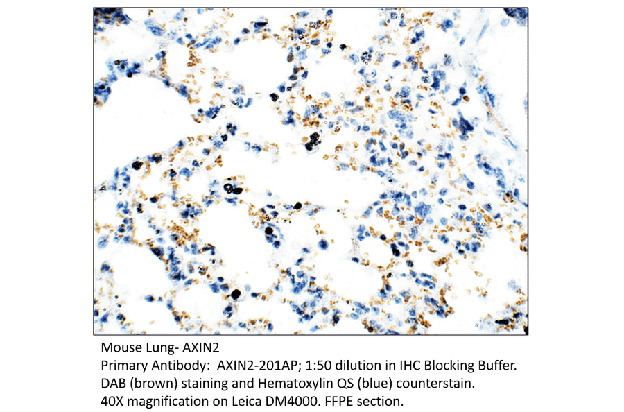 Anti-Axin 2 Antibody from FabGennix (AXIN2-201AP) - Antibodies.com