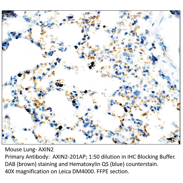Anti-Axin 2 Antibody from FabGennix (AXIN2-201AP) - Antibodies.com