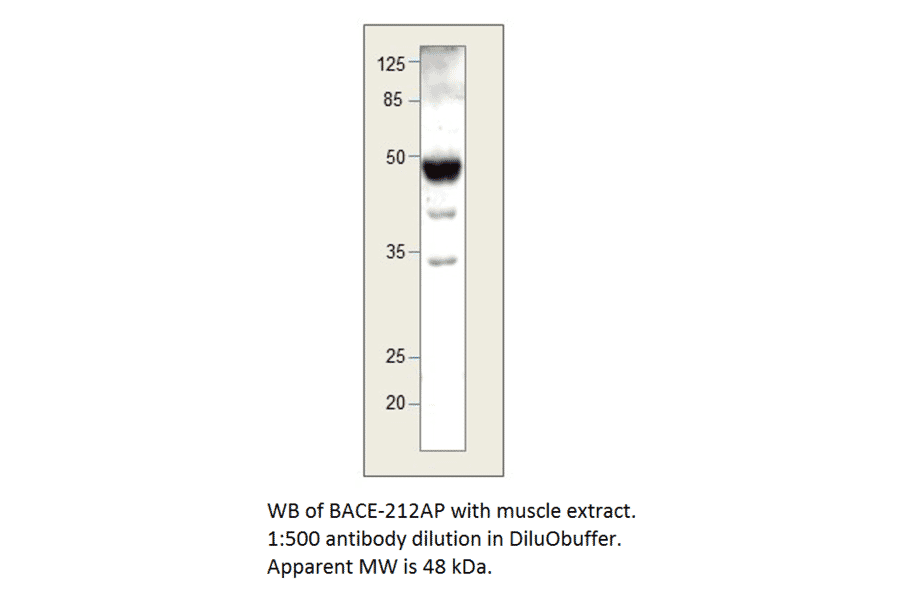 Anti-BACE2 B Antibody from FabGennix (BACE-212AP) - Antibodies.com