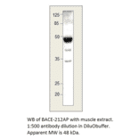 Anti-BACE2 B Antibody from FabGennix (BACE-212AP) - Antibodies.com