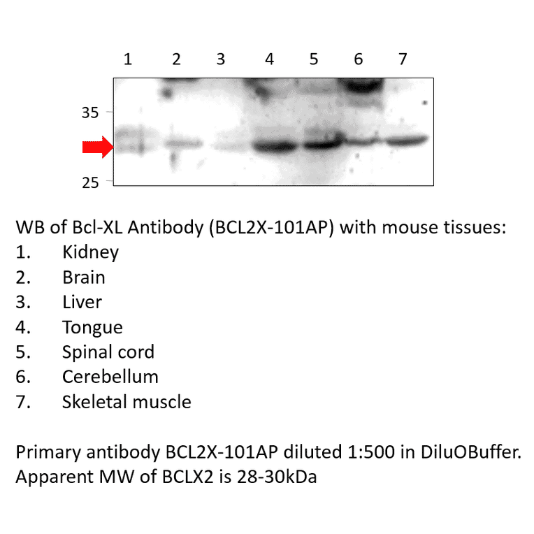 Anti-Bcl-XL Antibody from FabGennix (BCL2X-101AP) - Antibodies.com