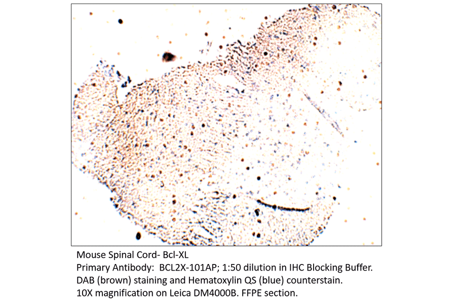 Anti-Bcl-XL Antibody from FabGennix (BCL2X-101AP) - Antibodies.com