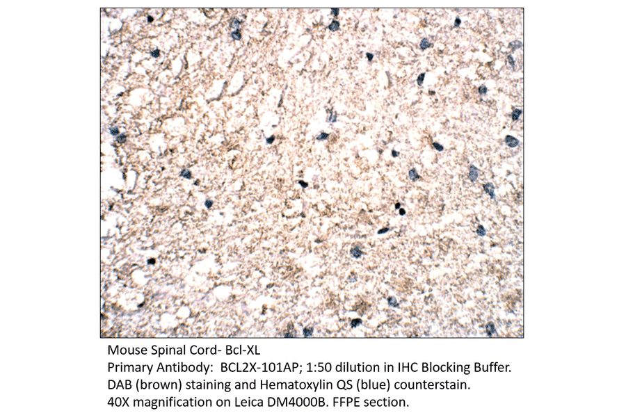 Anti-Bcl-XL Antibody from FabGennix (BCL2X-101AP) - Antibodies.com