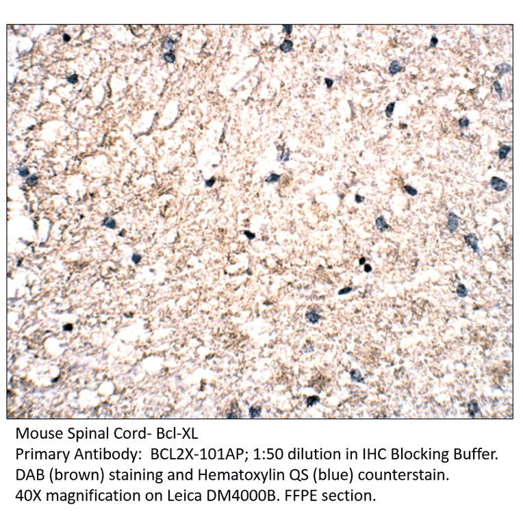 Anti-Bcl-XL Antibody from FabGennix (BCL2X-101AP) - Antibodies.com