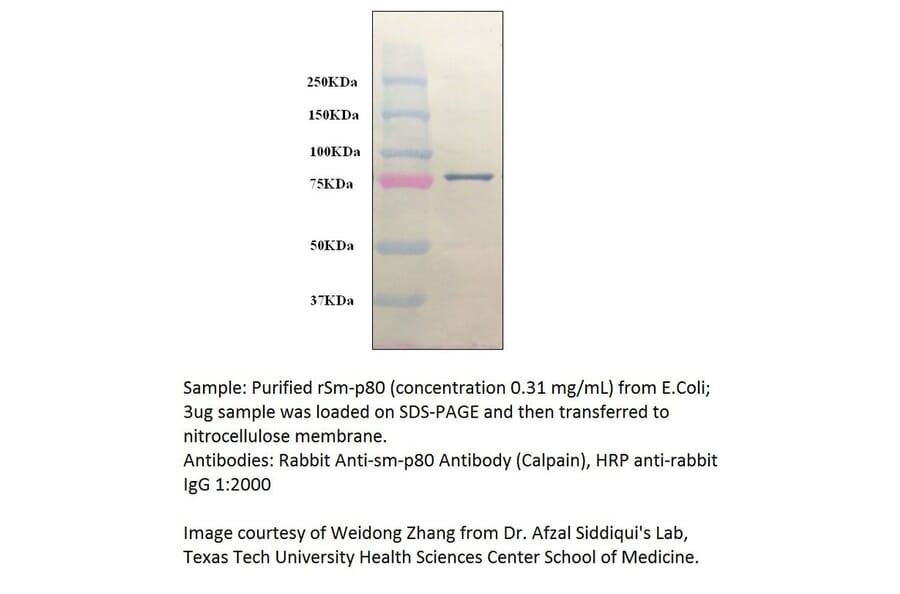 Anti-Calpain Antibody from FabGennix (CALP-101AP) - Antibodies.com