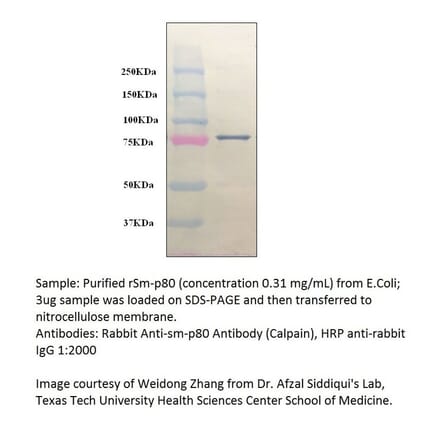 Anti-Calpain Antibody from FabGennix (CALP-101AP) - Antibodies.com