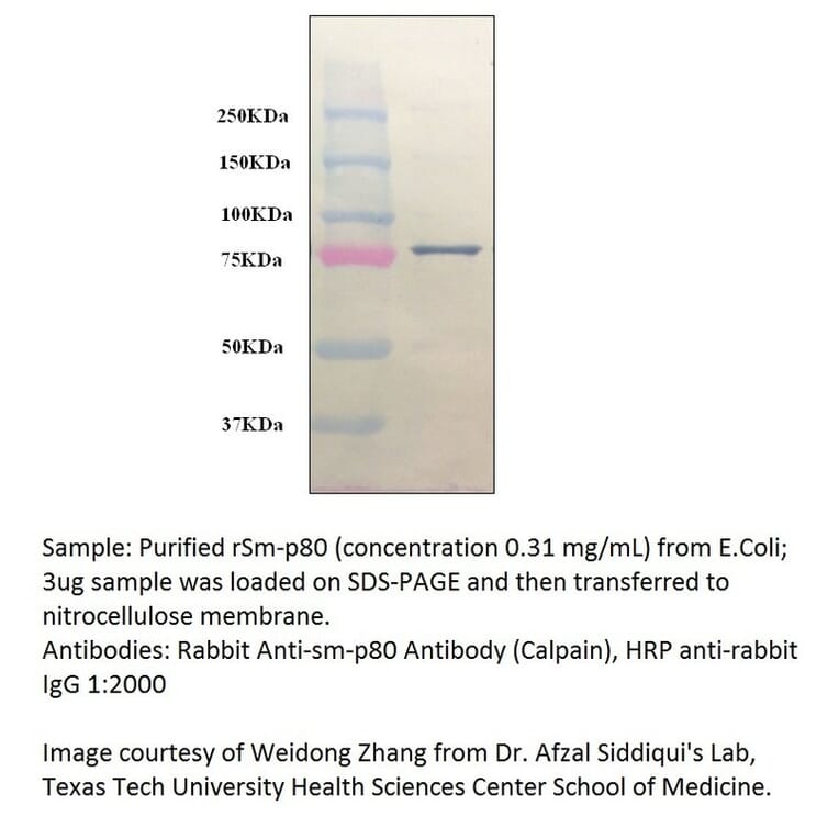 Anti-Calpain Antibody from FabGennix (CALP-101AP) - Antibodies.com