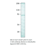 Anti-Calpain Antibody from FabGennix (CALP-101AP) - Antibodies.com