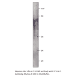 Anti-Calpain Antibody from FabGennix (CALP-101AP) - Antibodies.com