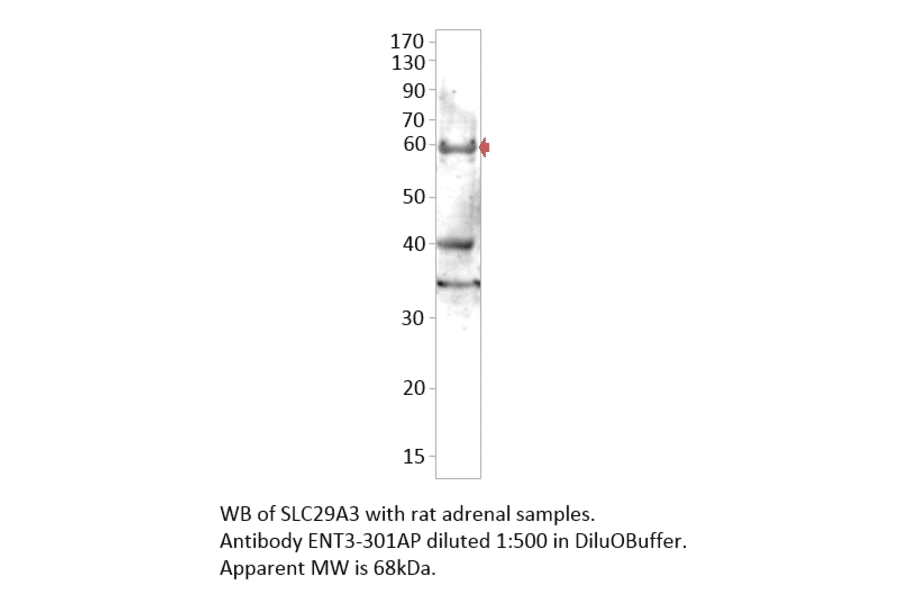 Anti-SLC29A3 Antibody from FabGennix (ENT3-301AP) - Antibodies.com