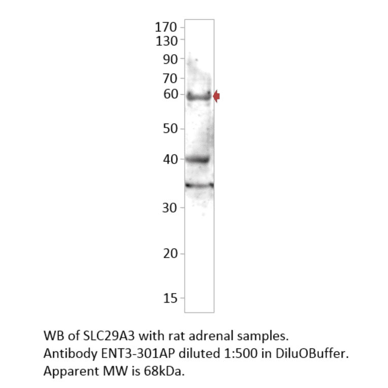 Anti-SLC29A3 Antibody from FabGennix (ENT3-301AP) - Antibodies.com