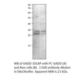 Anti-GADD45B Antibody from FabGennix (GADD-101AP) - Antibodies.com