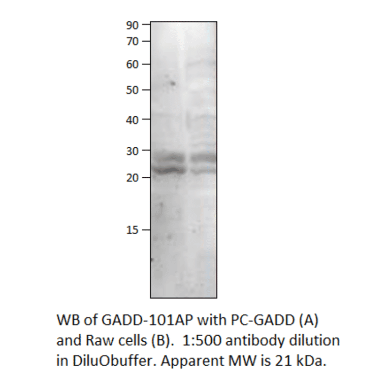 Anti-GADD45B Antibody from FabGennix (GADD-101AP) - Antibodies.com