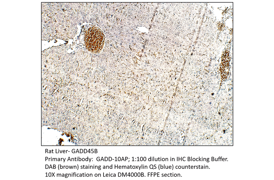 Anti-GADD45B Antibody from FabGennix (GADD-101AP) - Antibodies.com