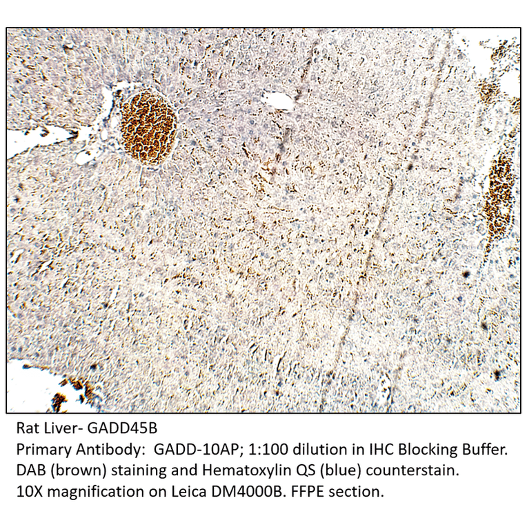 Anti-GADD45B Antibody from FabGennix (GADD-101AP) - Antibodies.com