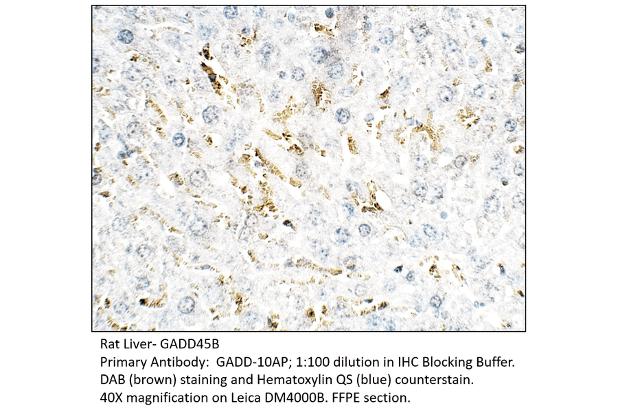Anti-GADD45B Antibody from FabGennix (GADD-101AP) - Antibodies.com