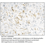 Anti-GADD45B Antibody from FabGennix (GADD-101AP) - Antibodies.com