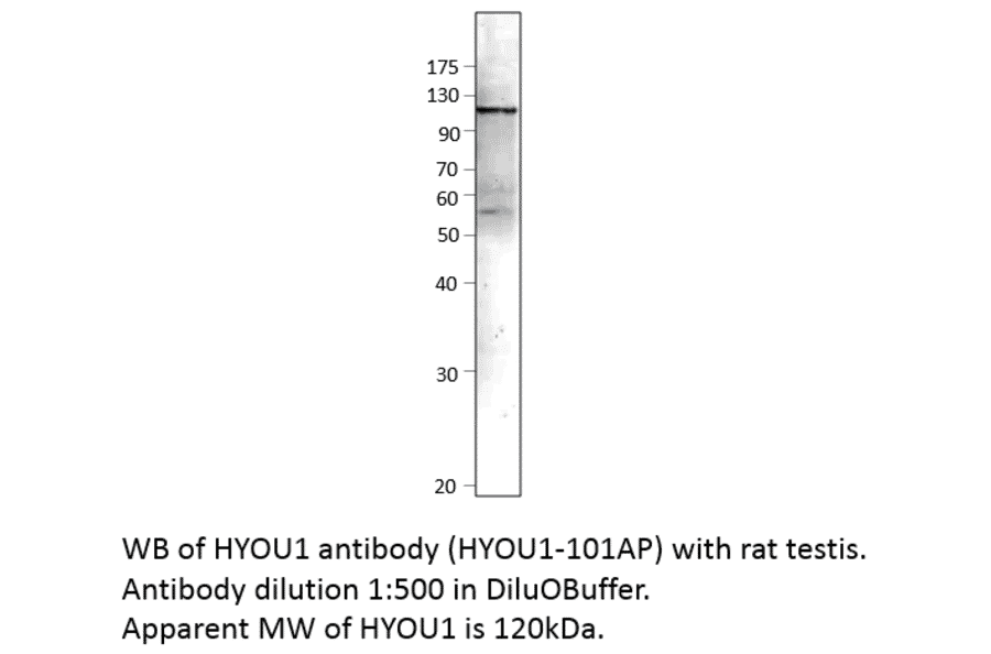 Anti-ORP150 Antibody from FabGennix (HYOU1-101AP) - Antibodies.com