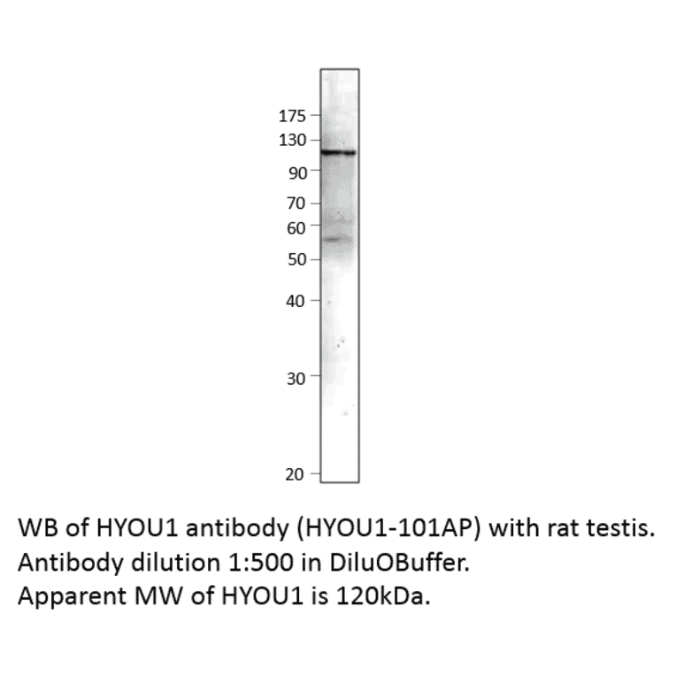 Anti-ORP150 Antibody from FabGennix (HYOU1-101AP) - Antibodies.com