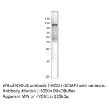 Anti-ORP150 Antibody from FabGennix (HYOU1-101AP) - Antibodies.com