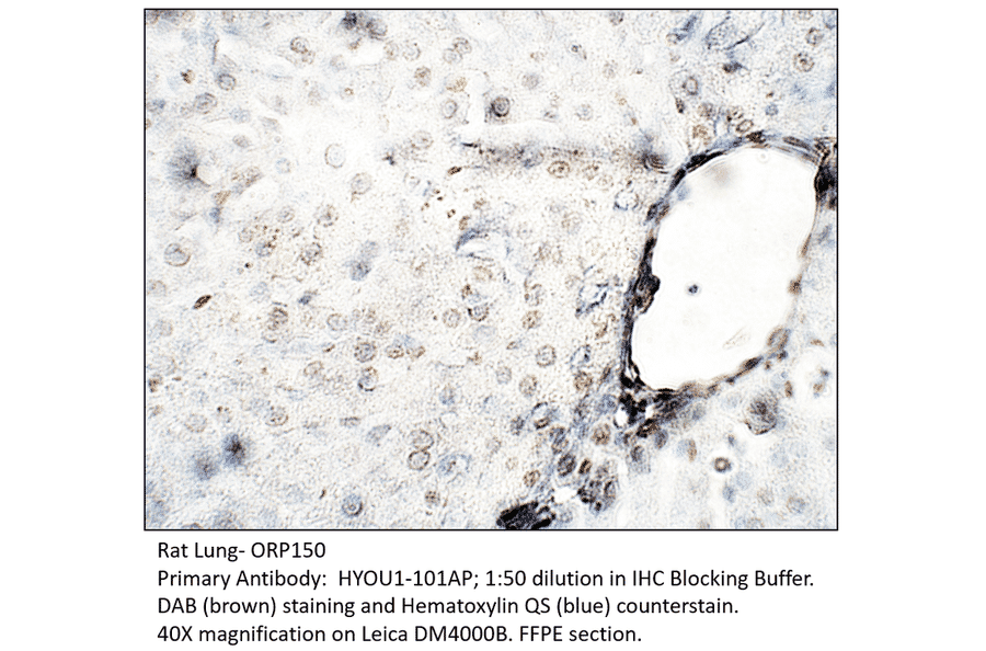 Anti-ORP150 Antibody from FabGennix (HYOU1-101AP) - Antibodies.com
