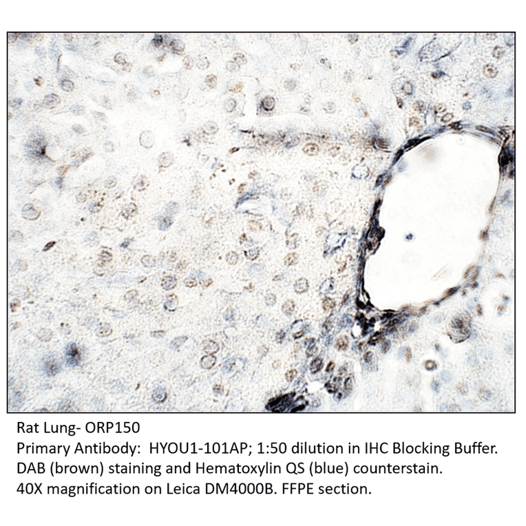 Anti-ORP150 Antibody from FabGennix (HYOU1-101AP) - Antibodies.com