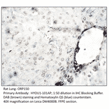 Anti-ORP150 Antibody from FabGennix (HYOU1-101AP) - Antibodies.com