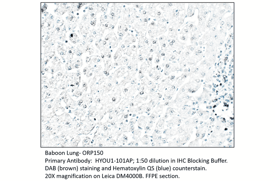 Anti-ORP150 Antibody from FabGennix (HYOU1-101AP) - Antibodies.com